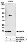 Detection of human PAM16 by western blot of immunoprecipitates.