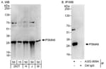 Detection of human and mouse PSMA6 by western blot (h and m) and immunoprecipitation (h).