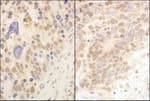 Detection of human and mouse Cul2 by immunohistochemistry.