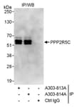 Detection of human PPP2R5C by western blot of immunoprecipitates.