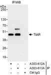 Detection of human TIAR by western blot of immunoprecipitates.