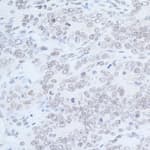 Detection of mouse Rad6 by immunohistochemistry.