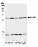 Detection of mouse RENT1 by western blot.