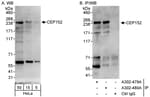 Detection of human CEP152 by western blot and immunoprecipitation.