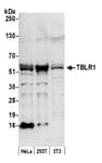 Detection of human and mouse TBLR1 by western blot.