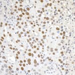 Detection of mouse Paf1 by immunohistochemistry.
