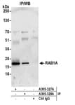 Detection of human RAB1A by western blot of immunoprecipitates.