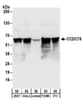 Detection of human and mouse CCDC76 by western blot.