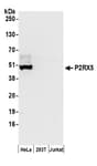 Detection of human P2RX5 by western blot.