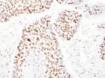 Detection of human PSME3 by immunohistochemistry.