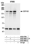 Detection of human CEP152 by western blot of immunoprecipitates.