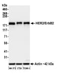 Detection of mouse HER2/ErbB2 by western blot.