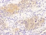 Detection of mouse CCT8 by immunohistochemistry.