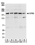 Detection of human and mouse EPRS by western blot.