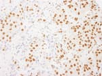 Detection of human RALY by immunohistochemistry.