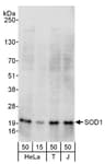Detection of human SOD1 by western blot.