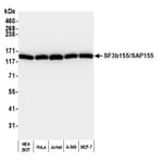 Detection of human SF3b155/SAP155 by western blot.