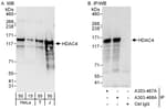 Detection of human HDAC4 by western blot and immunoprecipitation.