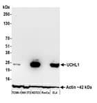 Detection of mouse UCHL1 by western blot.