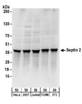 Detection of human and mouse Septin 2 by western blot.