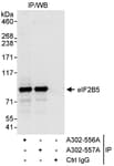 Detection of human eIF2B5 by western blot of immunoprecipitates.