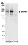 Detection of human Endofin by western blot.