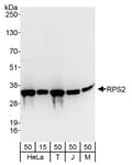 Detection of human and mouse RPS2 by western blot.