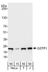 Detection of human GSTP1 by western blot.