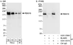 Detection of human and mouse RBM16 by western blot (h&amp;m) and immunoprecipitation (h).