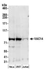 Detection of human VAC14 by western blot.