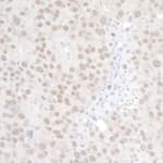 Detection of mouse p66alpha by immunohistochemistry.