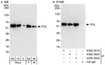 Detection of human and mouse TFG by western blot (h&amp;m) and immunoprecipitation (h).