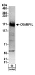 Detection of human CRAMP1L by western blot.