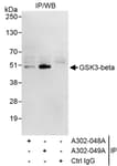 Detection of human GSK3-beta by western blot of immunoprecipitates.