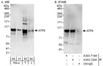Detection of human ATF6 by western blot and immunoprecipitation.