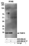 Detection of human PAM16 by western blot of immunoprecipitates.