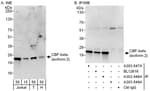 Detection of Isoform 2 of human CBF-beta by western blot and immunoprecipitation.