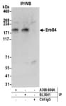 Detection of human ErbB4 by western blot of immunoprecipitates.