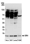Detection of human and mouse ERH by western blot.