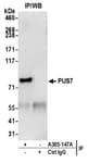 Detection of human PUS7 by western blot of immunoprecipitates.