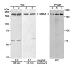 Detection of human SMC4 by western blot and immunoprecipitation.
