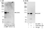 Detection of human SOX6 by western blot and immunoprecipitation.