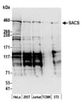 Detection of human and mouse SACS by western blot.
