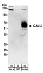 Detection of human ICAM-2 by western blot.