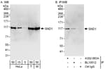 Detection of human and mouse SND1 by western blot (h&amp;m) and immunoprecipitation (h).