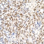 Detection of human Paf1 by immunohistochemistry.