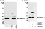 Detection of human and mouse p38 MAPK by western blot (h&amp;m) and immunoprecipitation (h).