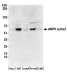 Detection of human and mouse AMPK alpha 2 by western blot.