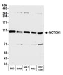 Detection of human NOTCH1 by western blot.