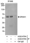 Detection of human DRAK1 by western blot of immunoprecipitates.
